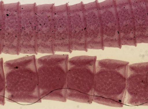Raillietina tetragona