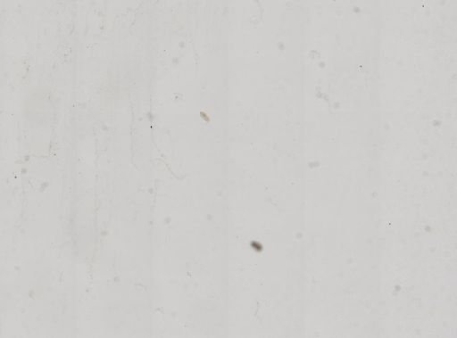 Paramecium