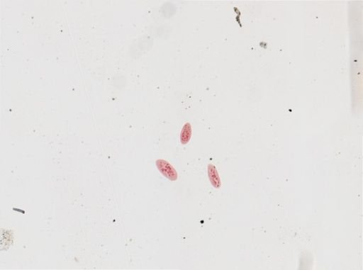 Paramecium calkinsi