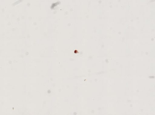 Trematoda