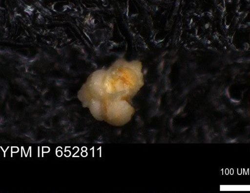 undet. Foraminiferida