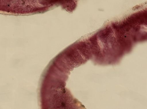 Halisarca sp.