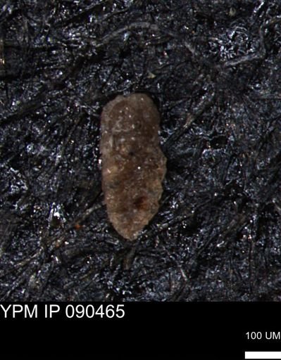 Verneuilina canadensis
