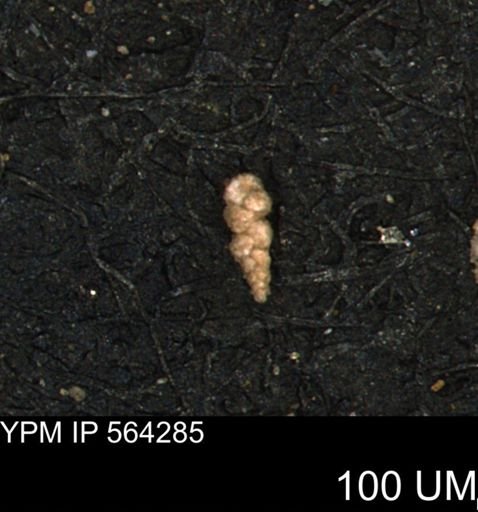 Verneuilina canadensis