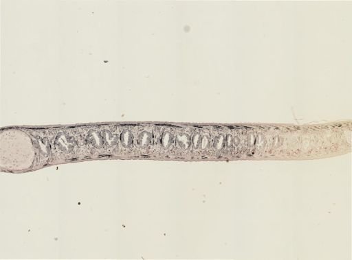 Turbellaria