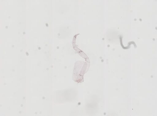 Hyalella cf. azteca