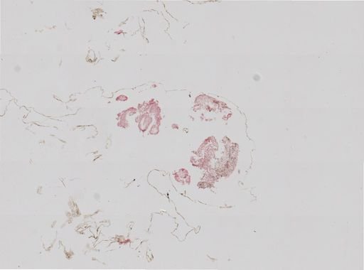 Distomum