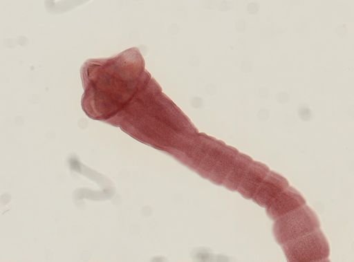 Dipylidium caninum
