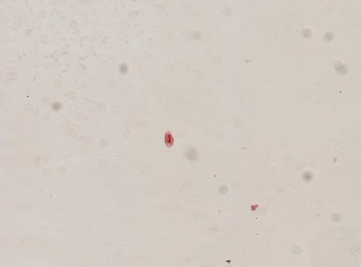 Oxytricha fallax