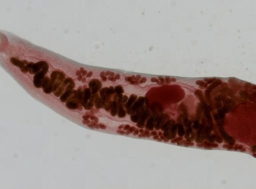 Haematoloechus medioplexus