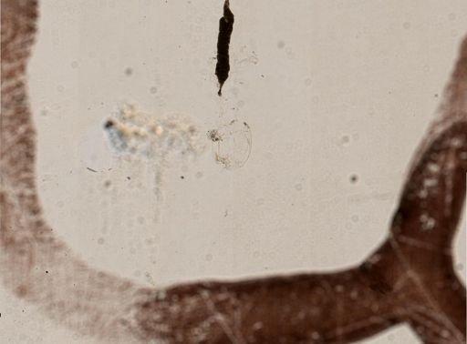 Cricotopus
