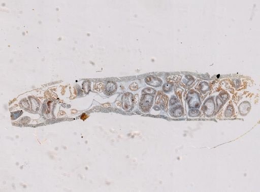 Prosadenoporus agricola