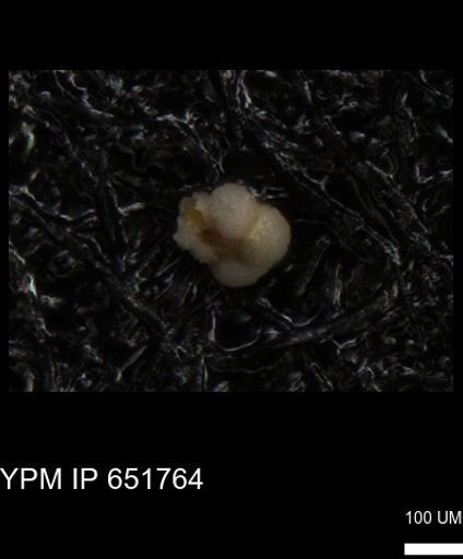 undet. Rugoglobigerinidae