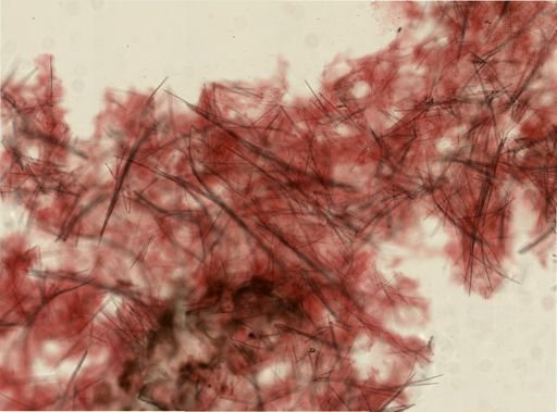 Halichondria bowerbanki