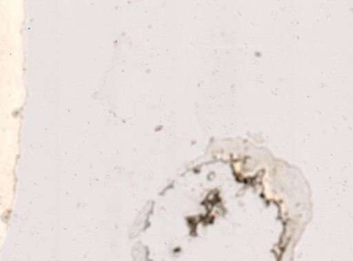 Paramecium
