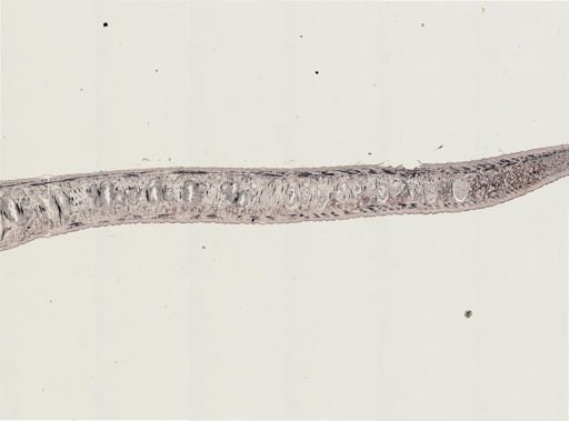 Turbellaria