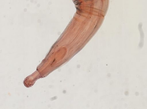 Oligacanthorhynchus microcephalus