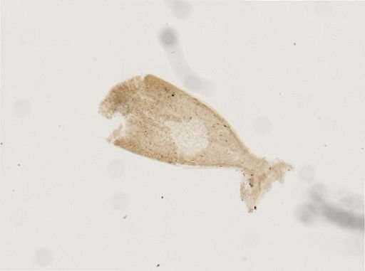 Licnophora?