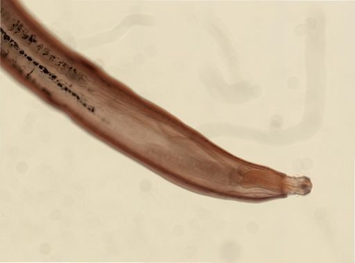 Neoechinorhynchus emydis