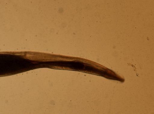 Enterobius vermicularis