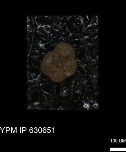 undet. Foraminiferida