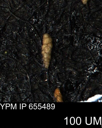 Verneuilina canadensis