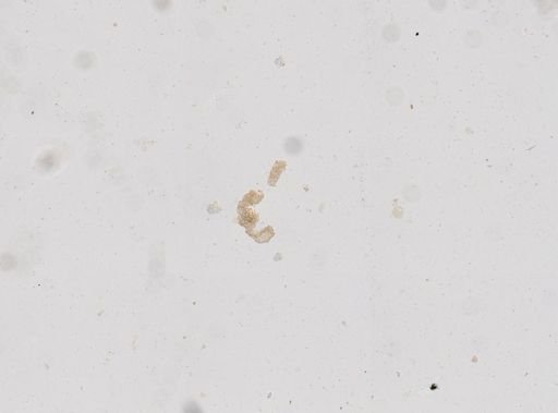 Strongyloides stercoralis