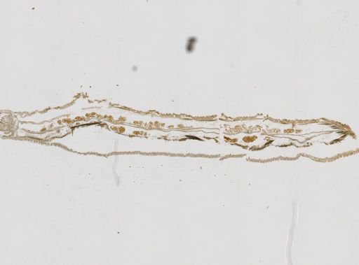 Phoronis psammophila