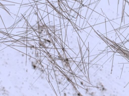 Tentorium semisuberites