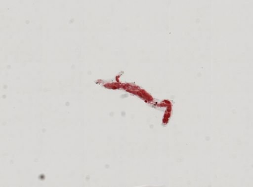 Trematoda