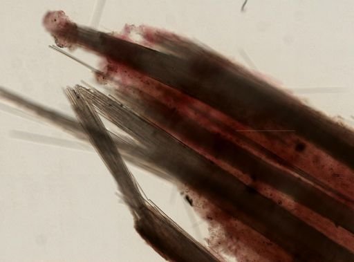 Tentorium semisuberites