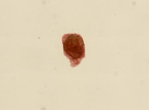 Tetracotyle