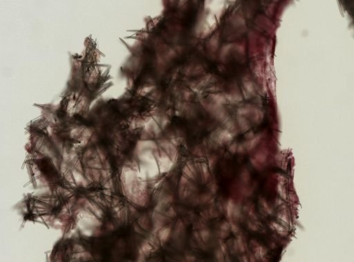 Myxilla cf. incrustans
