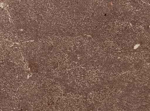 Entamoeba histolytica