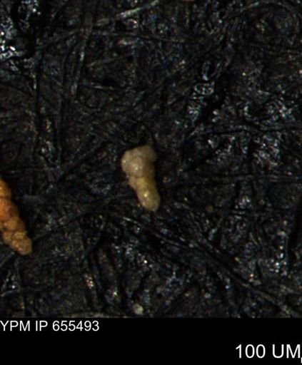 Verneuilina canadensis