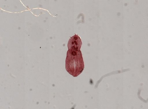 Posthodiplostomum minimum