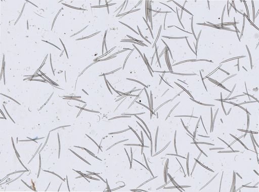 Xestospongia edapha