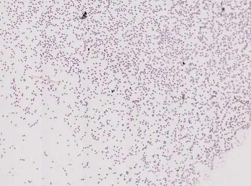 Trypanosoma diemyctyli