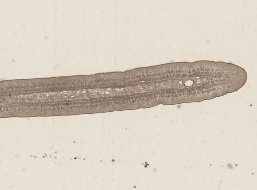 Taenia taeniaeformis