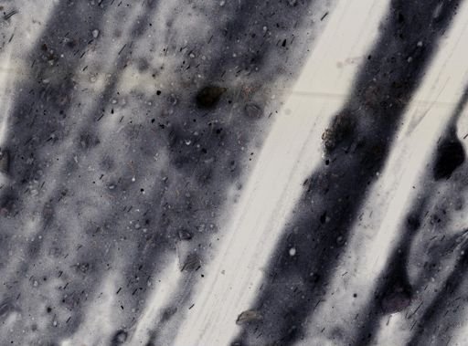 Entamoeba histolytica