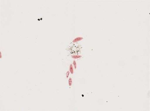Paramecium calkinsi