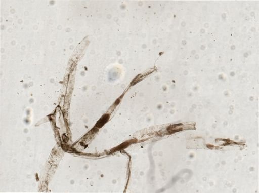 Victorella pavida