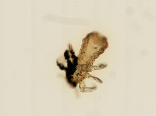 Pediculus humanus
