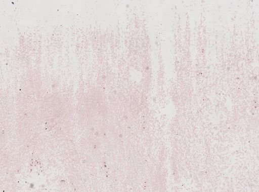 Plasmodium vivax