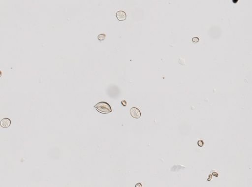 Cestoda