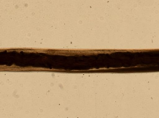 Ancylostoma caninum