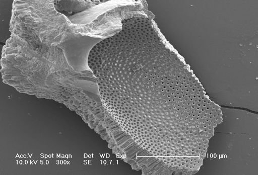 Globorotalia tumida