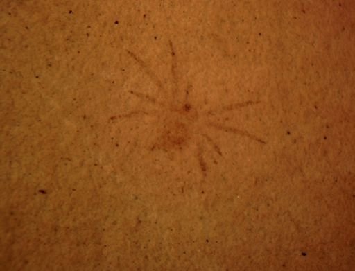 undet. Araneida
