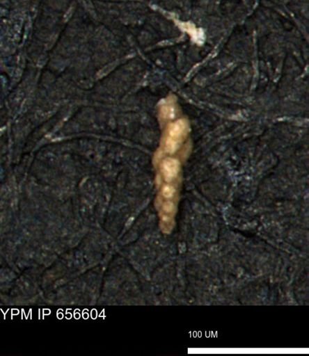 Verneuilina canadensis