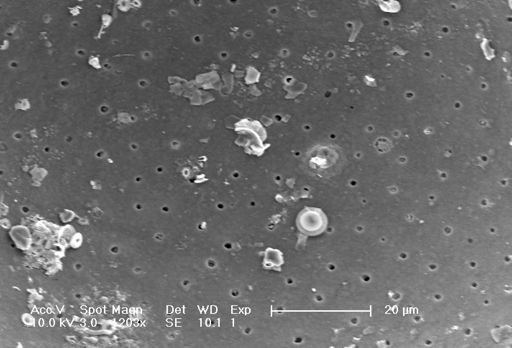 Globigerinella siphonifera